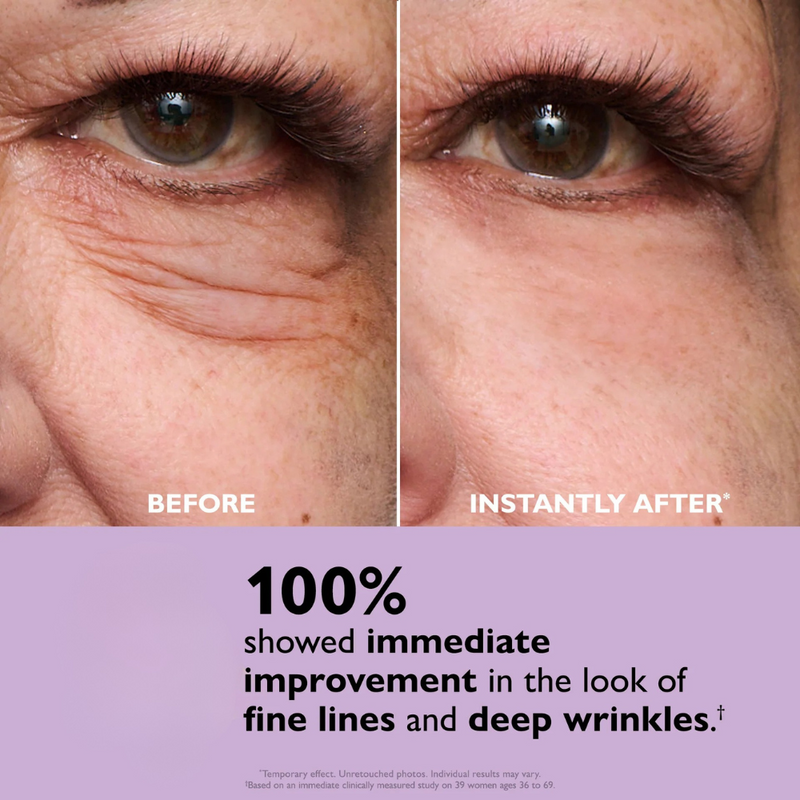 Apretado de ojos instantáneo